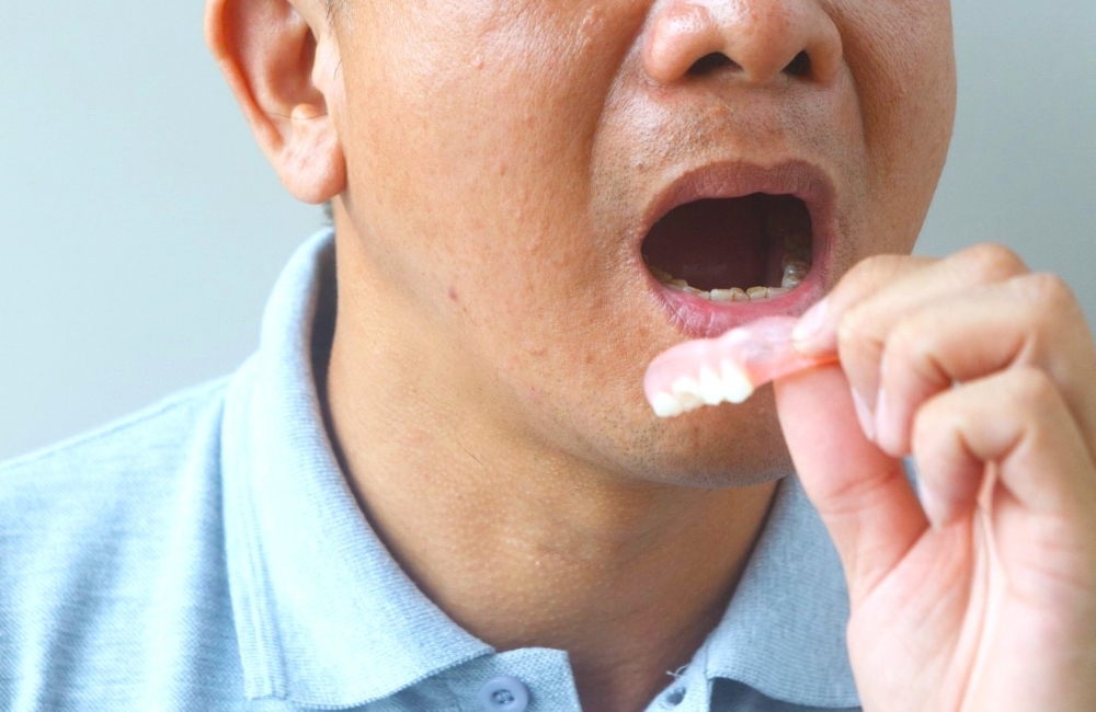 入れ歯を入れる様子