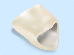 セラミックとレジン