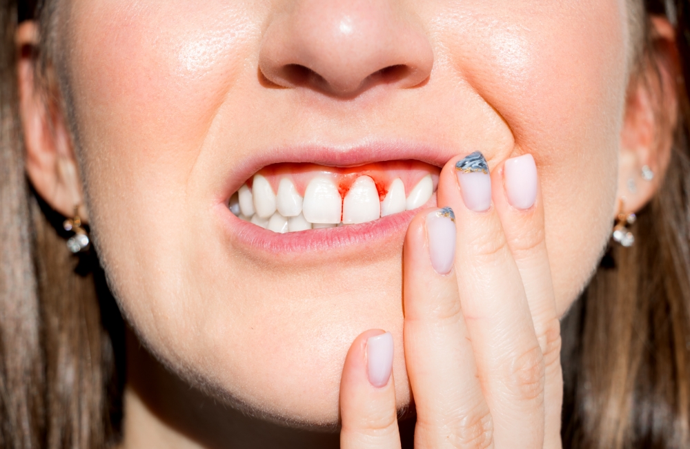 歯ぐきの腫れや出血